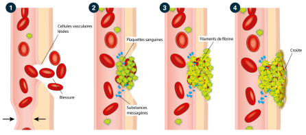 Abb. 8 Wundverschluss