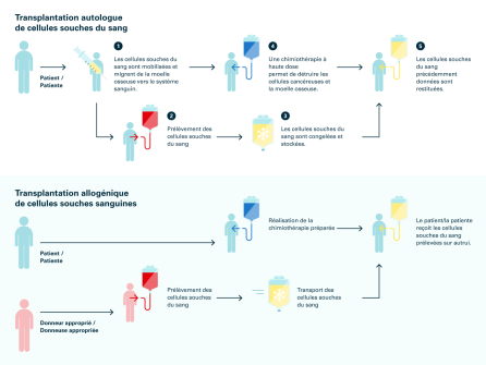 Schéma 3: Comparaison entre transplantation de cellules souches du sang autologue et allogénique. Source: Transfusion CRS Suisse (2023)